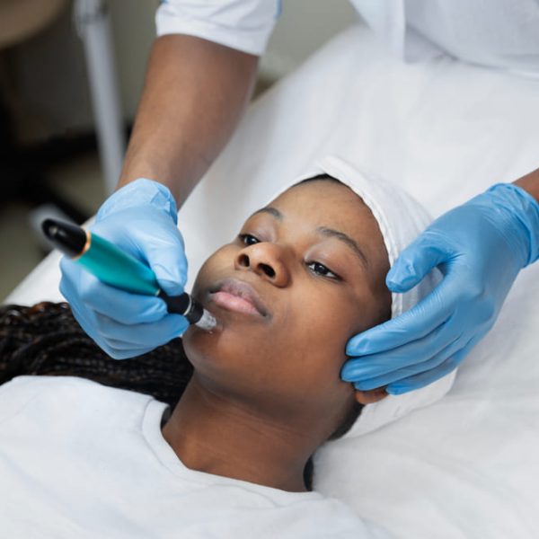 Diamond Microdermabrasion Diamond Microdermabrasion
